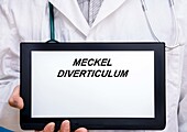 Meckel diverticulum, conceptual image