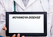 Moyamoya disease, conceptual image