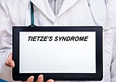 Tietze's syndrome, conceptual image