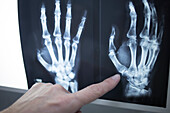 Doctor examining hand X-rays