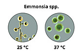 Emmonsia fungi, illustration