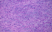 Artery wall intimal layer, light micrograph