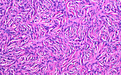 Ovary stromal cells, light micrograph