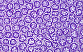 Colon epithelial crypt, light micrograph