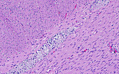 Bowel nerve plexus, light micrograph