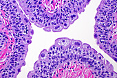 Umbrella urothelial cells, light micrograph