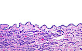 Mesothelial cells, light micrograph