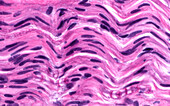 Nerve, light micrograph