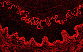 Artery wall, immunofluorescence light micrograph