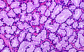 Brunnerâ€™s glands in a duodenum, light micrograph