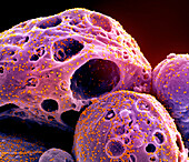 Cell infected by SARS-CoV-2 virus particles, SEM