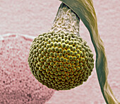 Oral fungi, SEM