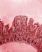 Small bowel tissue of a cholera patient, light micrograph