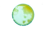 Bacteria cultured on Petri dish