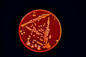 Bacteria cultured on Petri dish