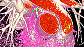 Aorta, pulmonary artery and vena cava, CT scan