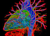 Healthy heart, CT scan