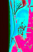 Human torso, CT scan