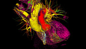 Healthy heart, CT scan