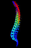 Spine, CT scan