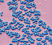 Group A Streptococcus bacteria, SEM