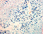 Kupffer cells, light micrograph