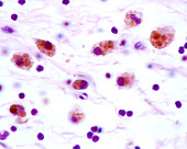 Macrophages, light micrograph