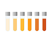 Urine colour chart, illustration