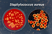 Staphylococcus aureus bacteria, illustration