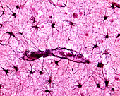 Protoplasmic astrocytes, light micrograph