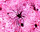 Astrocyte, light micrograph