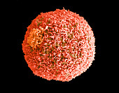 Lung cancer cell, SEM