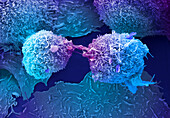 Lung cancer cells dividing, SEM