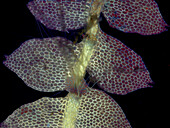 Liverwort gametophyte, fluorescence micrograph