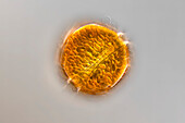 Peridinium cinctum algae, light micrograph