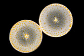 Coscinodiscus sp. algae, light micrograph
