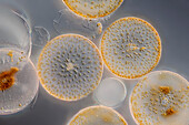 Coscinodiscus sp. algae, light micrograph