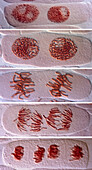 Mitosis in binucleate cells, light micrograph