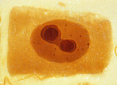 Segregated nucleolus, light micrograph