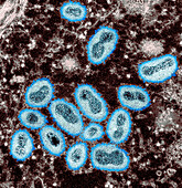 Mpox virus particles, TEM