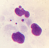 Chromosome missegregation, light micrograph