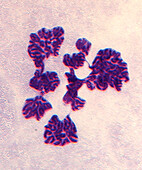 Chromosomes in topoisomerase II inhibited cell, light micrograph