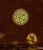 Pediastrum green algae, light micrograph