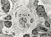 Macrophage in thymus, TEM