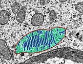Mitochondria, TEM