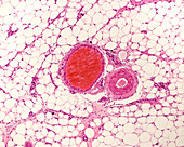 White adipose tissue, light micrograph