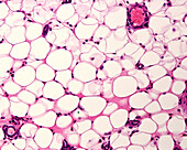 Adipose tissue, light micrograph