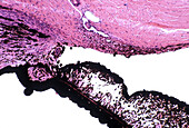 Schlemm canal in eye, light micrograph