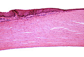 Human conjunctiva and cornea, light micrograph
