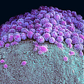 Organoid, SEM